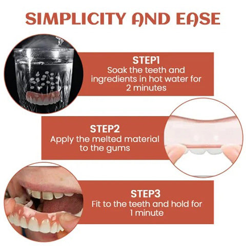 Custom Fit Denture Kit – Easy DIY Solution
