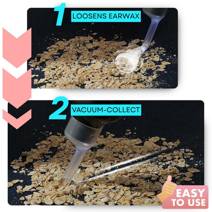 Earwax Vacuum – Safe & Painless Cleaning