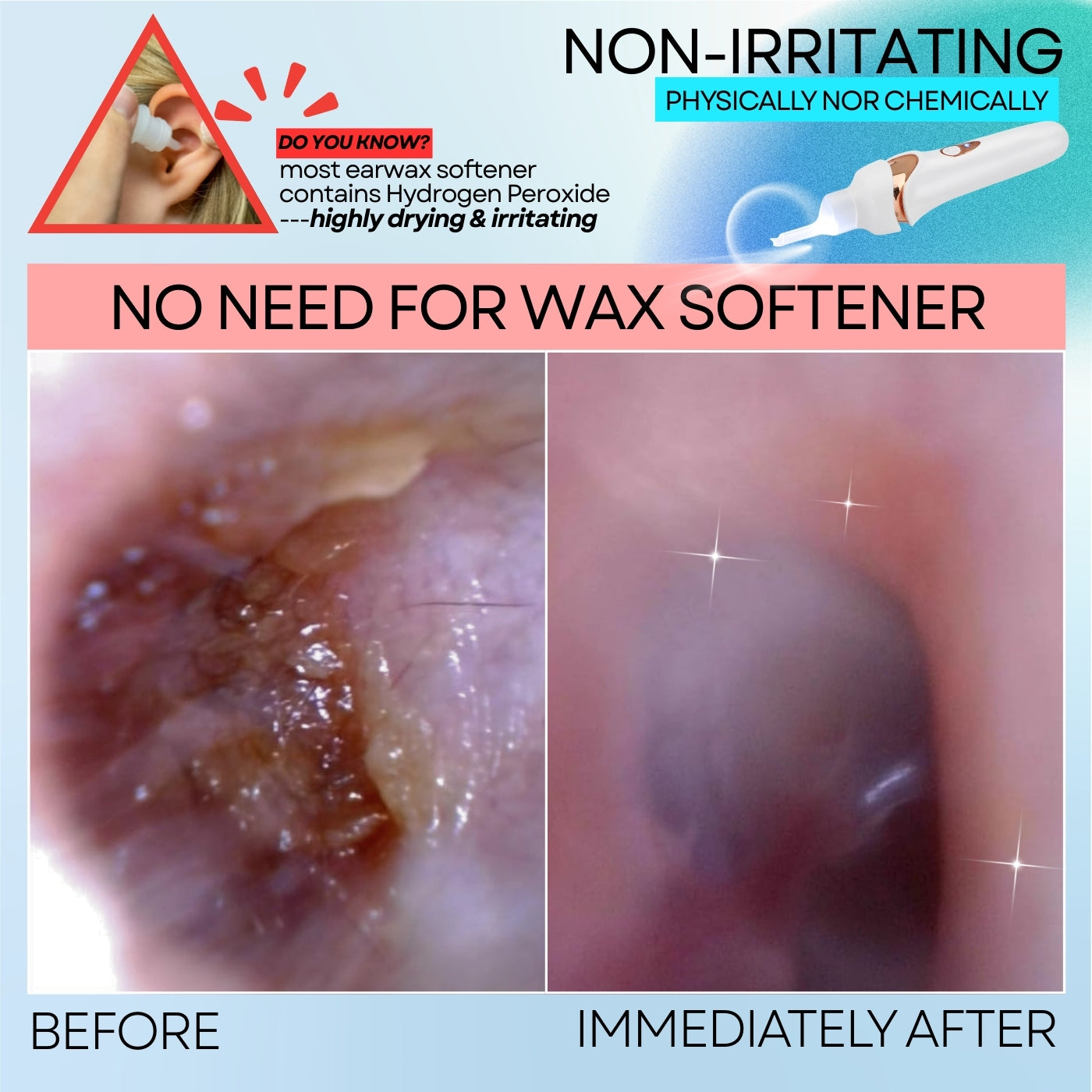 Earwax Vacuum – Safe & Painless Cleaning