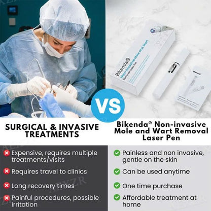 Laser Pen - Non-Invasive Mole and Wart Removal
