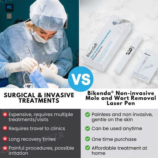 Laser Pen - Non-Invasive Mole and Wart Removal