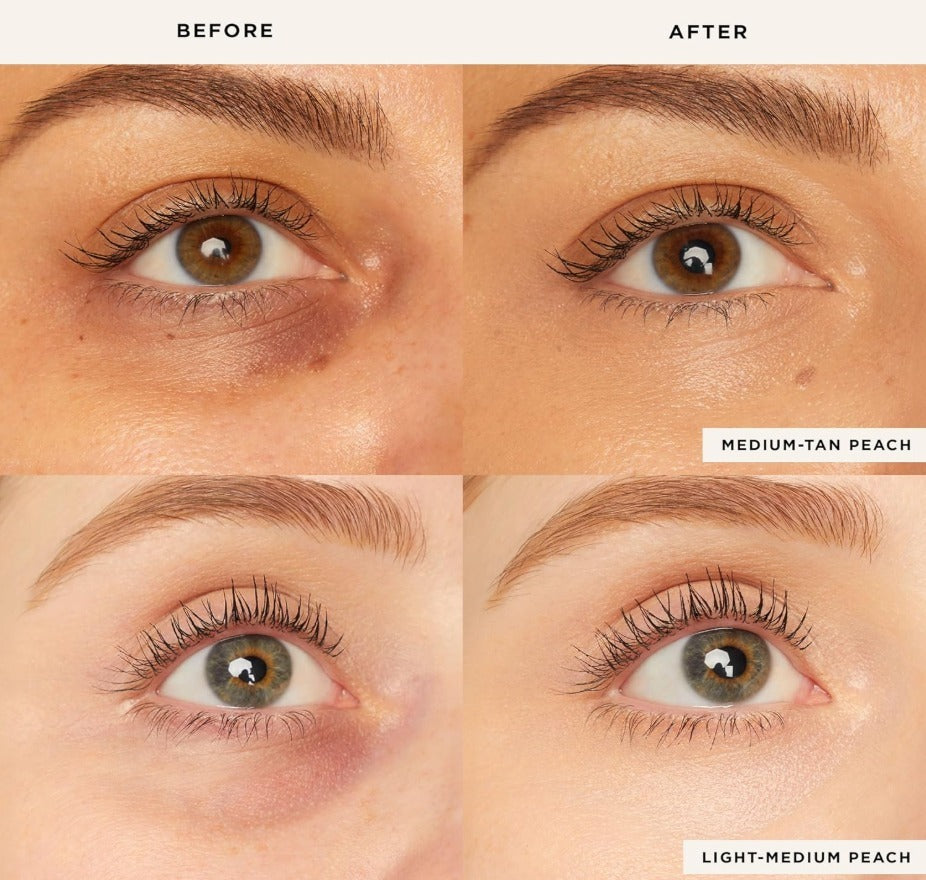 Radiant Eye Corrector