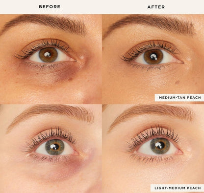 Radiant Eye Corrector