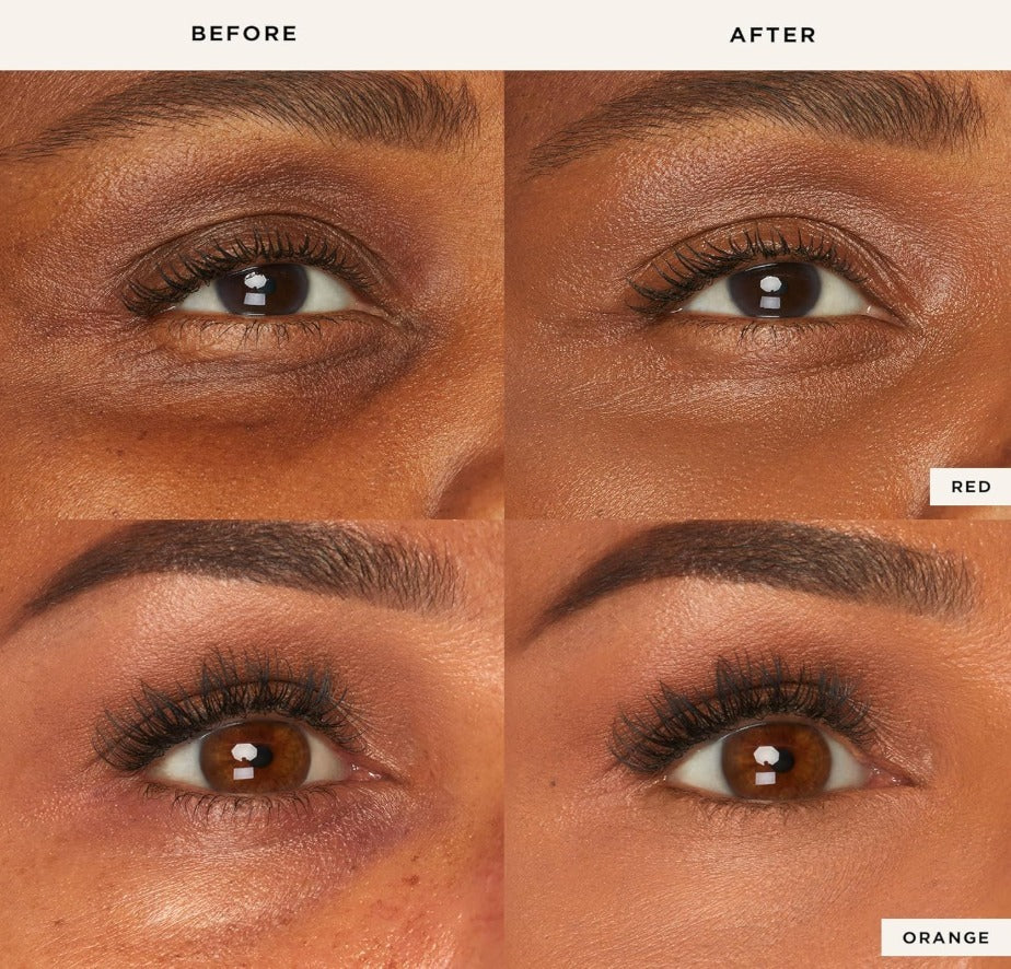 Radiant Eye Corrector