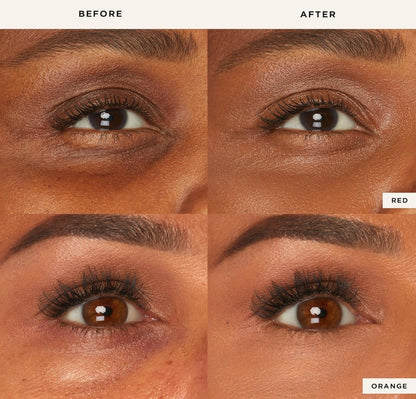 Radiant Eye Corrector